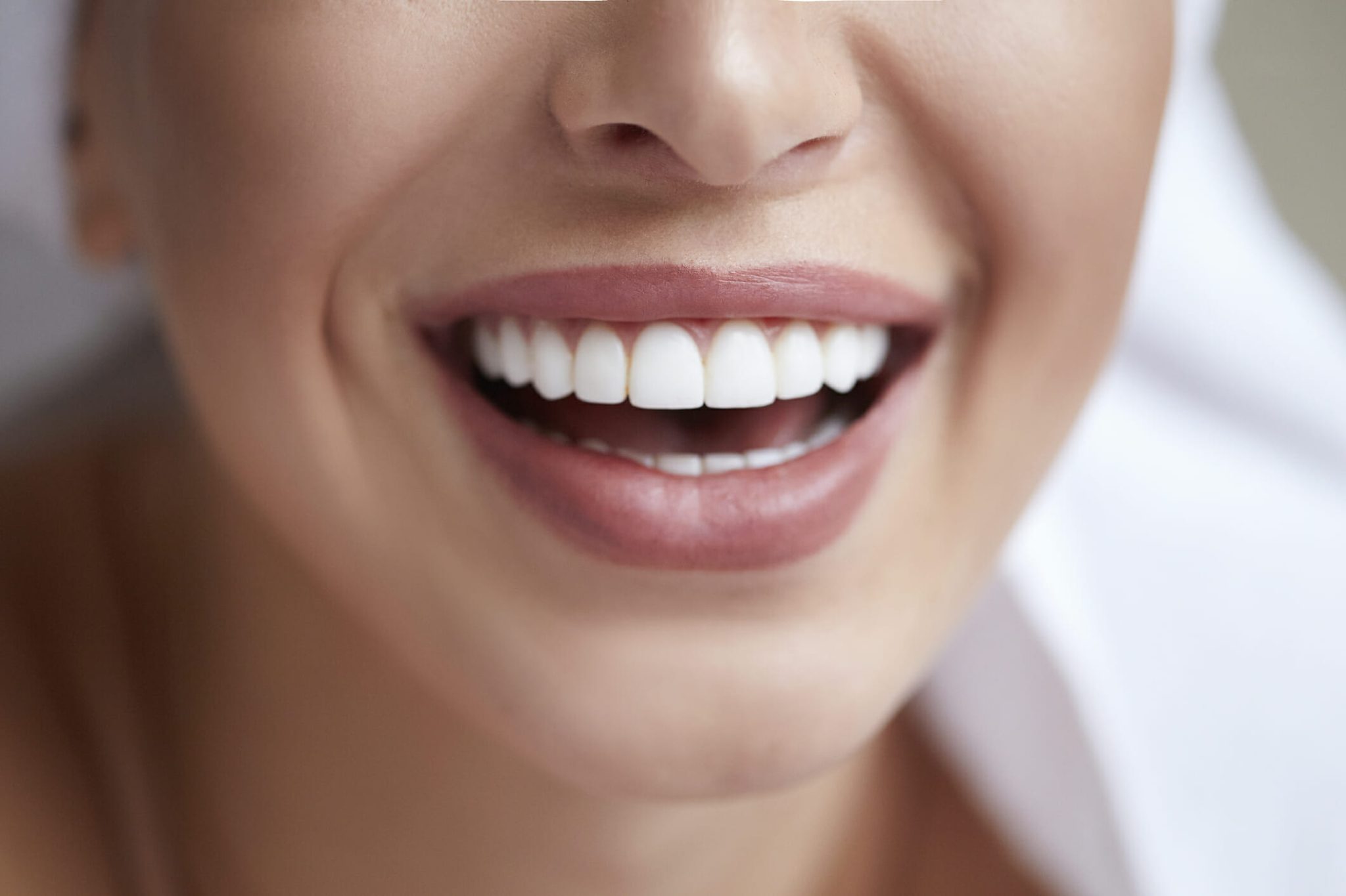 виниры зубы