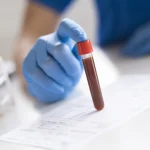 лаборатория анализ крови