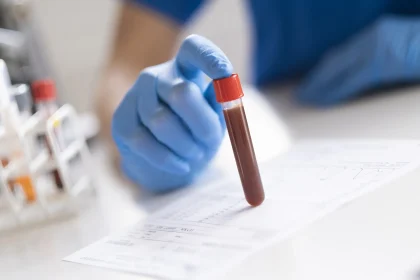 лаборатория анализ крови