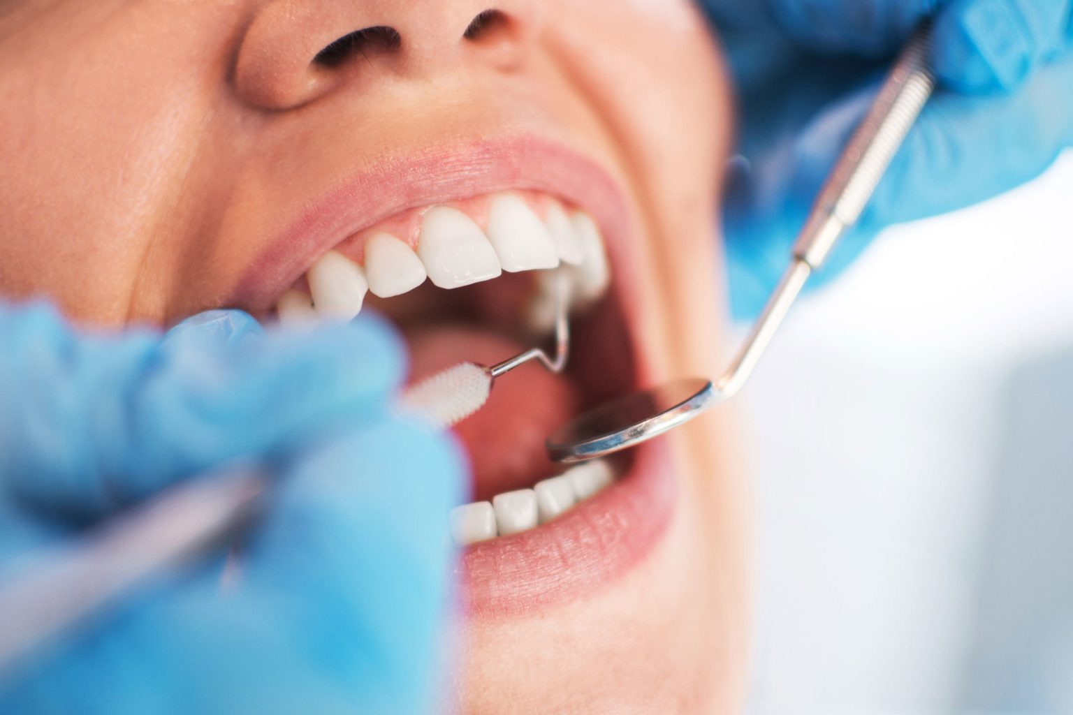 стоматолог зубы